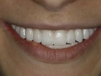 Konig Center for Cosmetic & Comprehensive Dentistry smile photos
